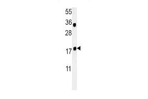 TPC6A Antibody (N-term)&65288,Cat(ABIN651480 and ABIN2840261)&65289,western blot analysis in Jurkat cell line lysates (35 μg/lane). (TRAPPC6A Antikörper  (N-Term))