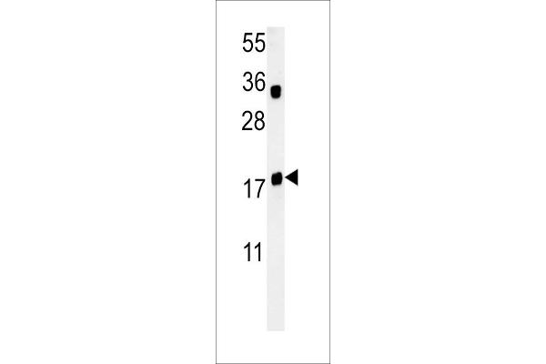TRAPPC6A Antikörper  (N-Term)