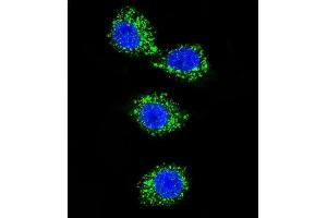 Confocal immunofluorescent analysis of P3 Antibody (C-term) (ABIN656992 and ABIN2846173) with MDA-M cell followed by Alexa Fluor 488-conjugated goat anti-rabbit lgG (green). (MPP3 Antikörper  (C-Term))