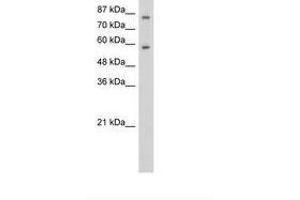 Image no. 1 for anti-Zinc Finger Protein 777 (ZNF777) (C-Term) antibody (ABIN6736254) (ZNF777 Antikörper  (C-Term))