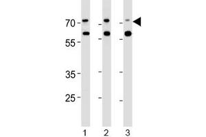 Acetylcholinesterase antibody western blot analysis in human 1) Jurkat, 2) Raji and 3) Y79 lysate.