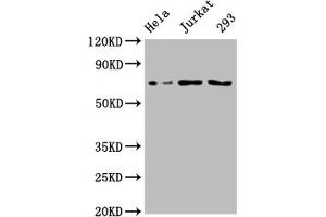 Western Blot Positive WB detected in: Hela whole cell lysate, Jurkat whole cell lysate, 293 whole cell lysate All lanes: INTS9 antibody at 1:2000 Secondary Goat polyclonal to rabbit IgG at 1/50000 dilution Predicted band size: 74, 72 kDa Observed band size: 74 kDa (INTS9 Antikörper  (AA 368-658))