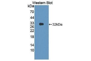 Western Blotting (WB) image for anti-Semaphorin 7A, GPI Membrane Anchor (John Milton Hagen Blood Group) (SEMA7A) (AA 318-566) antibody (ABIN1870746) (SEMA7A Antikörper  (AA 318-566))
