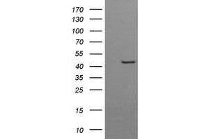 Image no. 2 for anti-butyrobetaine (Gamma), 2-Oxoglutarate Dioxygenase (Gamma-butyrobetaine Hydroxylase) 1 (BBOX1) antibody (ABIN1496815) (BBOX1 Antikörper)