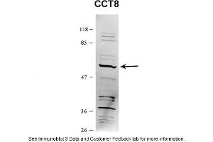 Sample Type: HEK 293 (10ug)Primary Dilution: 1:1000Secondary Antibody: conjugated goat anti-rabbitSecondary Dilution: 1:10,000Image Submitted By: Amy GrayBrigham Young University (CCT8 Antikörper  (C-Term))