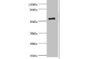 Western blot All lanes: Zinc finger protein Aiolos antibody at 8 μg/mL + HepG2 whole cell lysate Secondary Goat polyclonal to rabbit IgG at 1/10000 dilution Predicted band size: 59, 52, 54, 30, 48, 50, 55, 42, 36, 33, 43, 31 kDa Observed band size: 59 kDa (IKZF3 Antikörper  (AA 280-450))