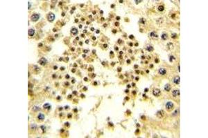 Immunohistochemistry (IHC) image for anti-Lin-28 Homolog B (LIN28B) (AA 95-128) antibody (ABIN3031627)