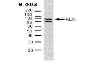 Western Blotting (WB) image for anti-Programmed Cell Death 6 Interacting Protein (PDCD6IP) antibody (ABIN181090) (ALIX Antikörper)