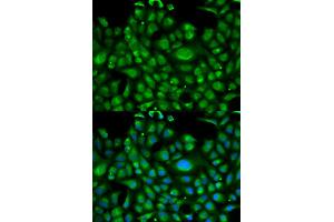 Immunofluorescence analysis of U2OS cells using HSPA1L antibody (ABIN5970952).
