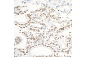 Immunohistochemistry (IHC) image for anti-Bromodomain Containing 3 (BRD3) (AA 676-726) antibody (ABIN7453851) (BRD3 Antikörper  (AA 676-726))