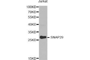 Western Blotting (WB) image for anti-Synaptosomal-Associated Protein, 29kDa (SNAP29) antibody (ABIN1874886) (SNAP29 Antikörper)