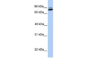 WB Suggested Anti-GGTL3 Antibody Titration:  0. (GGT7 Antikörper  (C-Term))