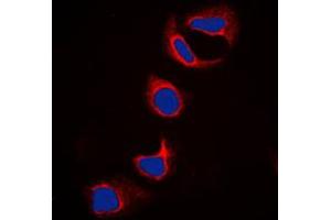 Immunofluorescent analysis of IFITM3 staining in HeLa cells. (IFITM3 Antikörper  (N-Term))