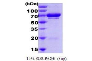 SDS-PAGE (SDS) image for Ubiquitin-Conjugating Enzyme E2G 2 (UBE2G2) protein (ABIN666841) (UBE2G2 Protein)