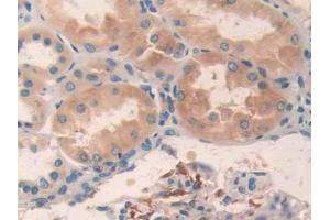 DAB staining on IHC-P; Samples: Human Kidney Tissue (AMP Activated Protein Kinase Alpha2 (AA 252-493) Antikörper)