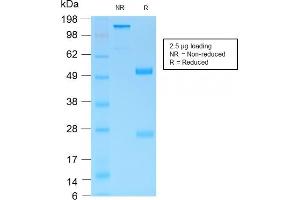 SDS-PAGE Analysis Purified MUC6 Rabbit Recombinant Monoclonal Antibody (MUC6/1553R). (Rekombinanter MUC6 Antikörper)