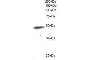 Image no. 1 for anti-Neutrophil Cytosol Factor 1 (NCF1) (C-Term) antibody (ABIN374079) (NCF1 Antikörper  (C-Term))