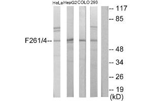 Western blot analysis of extracts from HeLa cells, HepG2 cells, COLO205 cells and 293 cells, using PFKFB1/4 antibody.