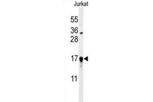 Western Blotting (WB) image for anti-Glutaredoxin 5 (GLRX5) antibody (ABIN3002211) (GLRX5 Antikörper)