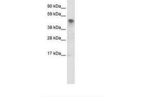Image no. 1 for anti-Jumonji Domain Containing 5 (JMJD5) (C-Term) antibody (ABIN6735928) (JMJD5 Antikörper  (C-Term))