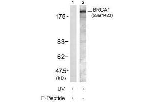 Image no. 2 for anti-Breast Cancer 1 (BRCA1) (pSer1423) antibody (ABIN196994) (BRCA1 Antikörper  (pSer1423))