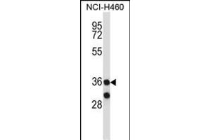 MARCH11 antibody  (C-Term)