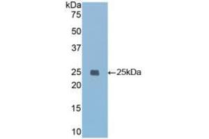 Western blot analysis of recombinant Mouse IGFBP7.