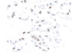 Immunocytochemistry (ICC) image for anti-Structural Maintenance of Chromosomes 1A (SMC1A) (C-Term) antibody (ABIN7455193) (Rekombinanter SMC1A Antikörper  (C-Term))