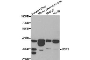 Western blot analysis of extracts of various cell lines, using UCP1 antibody. (UCP1 Antikörper)