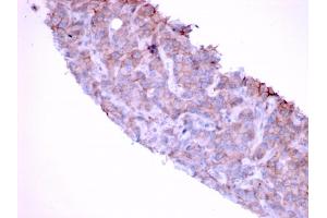 Formalin-fixed, paraffin-embedded human Bladder stained with EGFR Mouse Monoclonal Antibody (GFR/1667). (EGFR Antikörper)