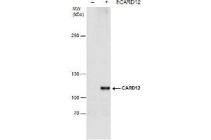 WB Image CARD12 antibody detects CARD12 protein by western blot analysis. (NLRC4 Antikörper  (N-Term))