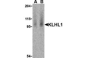 Western Blotting (WB) image for anti-Kelch-Like 1 (KLHL1) (N-Term) antibody (ABIN1031428) (KLHL1 Antikörper  (N-Term))