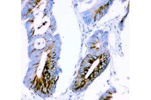 IHC analysis of Ataxin 1 using anti-Ataxin 1 antibody (ABIN3043506).
