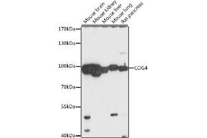 Western blot analysis of extracts of various cell lines, using COG4 antibody (ABIN7266486) at 1:1000 dilution. (COG4 Antikörper  (AA 310-410))