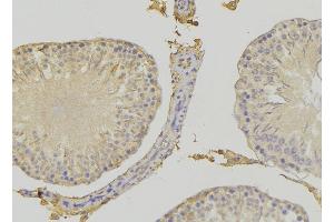 ABIN6272415 at 1/100 staining RAT testis tissue by IHC-P. (RHOBTB3 Antikörper  (Internal Region))
