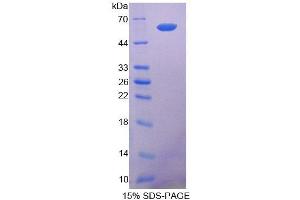SDS-PAGE (SDS) image for Collagen, Type I, alpha 2 (COL1A2) (AA 1057-1339) protein (His tag,GST tag) (ABIN4988359)