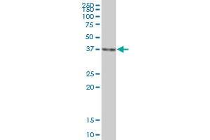 Western Blotting (WB) image for anti-DNA Fragmentation Factor, 45kDa, alpha Polypeptide (DFFA) (AA 1-331) antibody (ABIN514953)