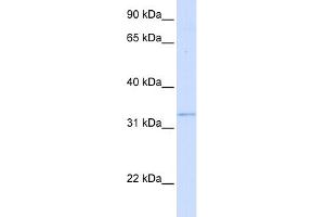 WB Suggested Anti-GGPS1 Antibody Titration:  0. (GGPS1 Antikörper  (Middle Region))