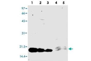 Western blot analysis of PCSK9 (prodomain) monoclonal antibody, clone KS-2C8 . (PCSK9 Antikörper)