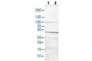 Western blot analysis of Lane 1: NIH/3T3 cell lysate and Lane 2: NBT-II cell lysate with CD36 polyclonal antibody . (CD36 Antikörper  (AA 42-178))