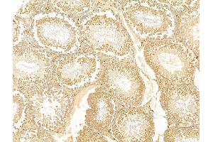 ABIN7094882 and ABIN7098935 at 1/100 staining Rat testis tissue by IHC-P.