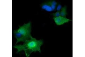 Image no. 2 for anti-HRas proto-oncogene, GTPase (HRAS) antibody (ABIN1498715) (HRAS Antikörper)