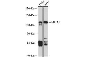 Western blot analysis of extracts of various cell lines, using M antibody (ABIN3023031, ABIN3023032, ABIN3023033, ABIN1513170 and ABIN6219356) at 1:1000 dilution. (MALT1 Antikörper  (AA 125-450))