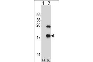 Western blot analysis of CRYAB (arrow) using rabbit polyclonal CRYAB Antibody (Center) (ABIN657620 and ABIN2846616). (CRYAB Antikörper  (AA 84-112))