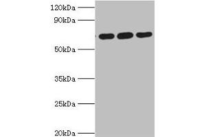 Western blot All lanes: ATAD3A antibody at 4 μg/mL Lane 1: A549 whole cell lysate Lane 2: Mouse spleen tissue Lane 3: Mouse liver tissue Secondary Goat polyclonal to rabbit IgG at 1/10000 dilution Predicted band size: 72, 67, 58 kDa Observed band size: 72 kDa (ATAD3A Antikörper  (AA 1-240))