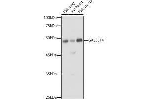 Western blot analysis of extracts of various cell lines, using GST4 antibody (ABIN6135004, ABIN6140932 and ABIN7101748) at 1:1000 dilution. (GAL3ST4 Antikörper)
