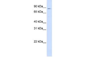 WB Suggested Anti-CPT1A Antibody Titration:  0. (CPT1A Antikörper  (Middle Region))