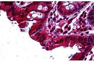Human Colon: Formalin-Fixed, Paraffin-Embedded (FFPE) (TAB2 Antikörper  (AA 161-173))