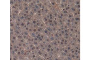Immunohistochemistry (IHC) image for anti-Nuclear Receptor Subfamily 1, Group I, Member 3 (NR1I3) (AA 1-247) antibody (ABIN5013391)