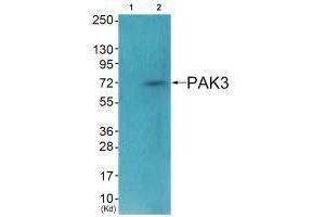 Western blot analysis of extracts from HeLa cells (Lane 2), using PAK3 (Ab-154) antiobdy. (PAK3 Antikörper  (Ser154))